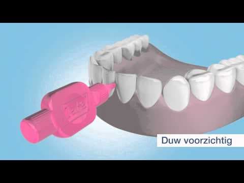 TePe Ragers Original 0,6 mm Blauw Voordeelpak video review videominiatuur
