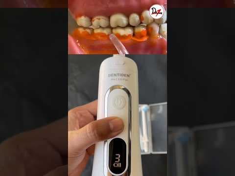 Dentect Waterflosser met Tongschraper video videominiatuur
