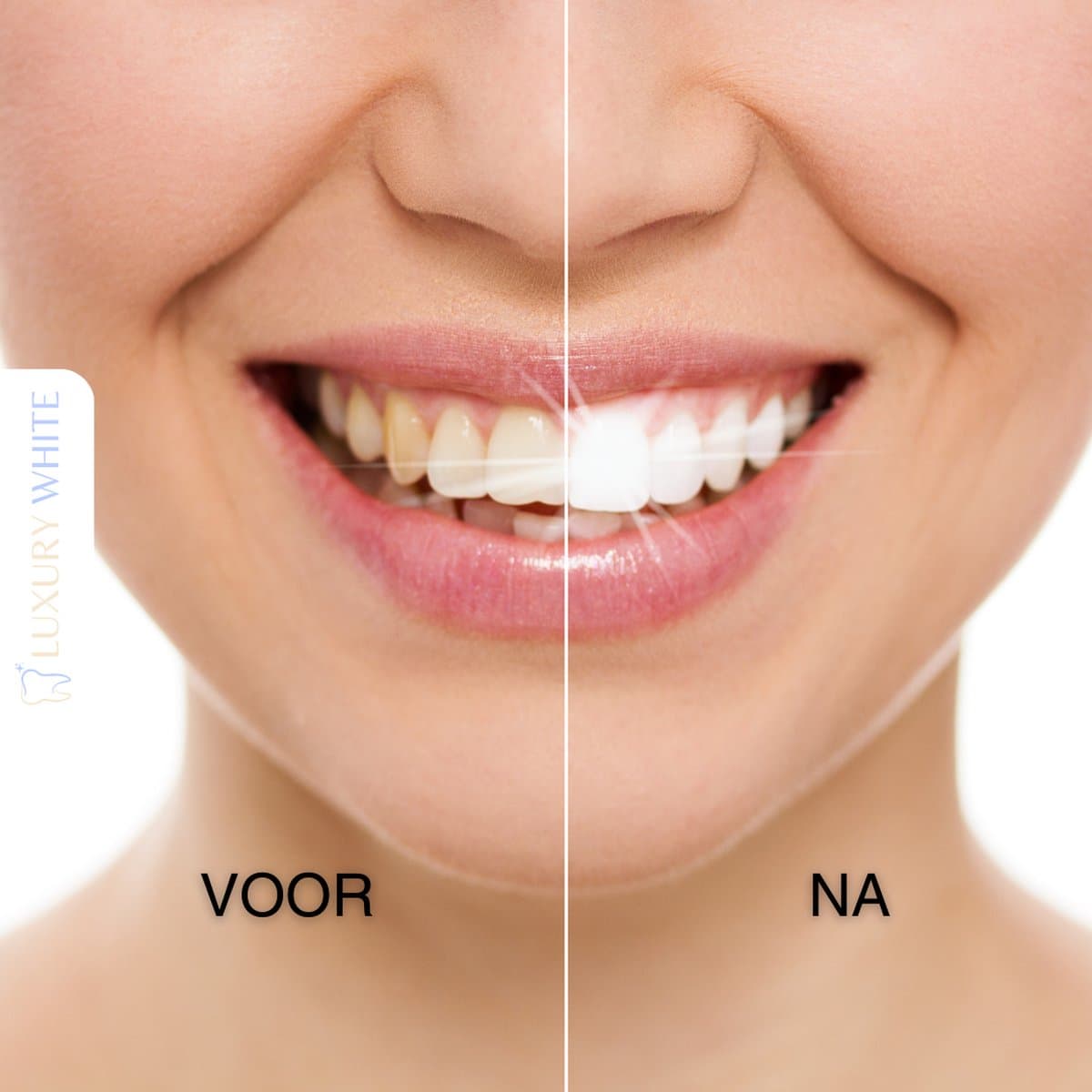Luxury White PAP+ Whitening Strips thumbnail 2