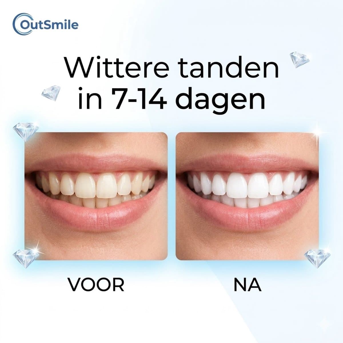 Outsmile 3D Luxe Whitening Strips thumbnail 9