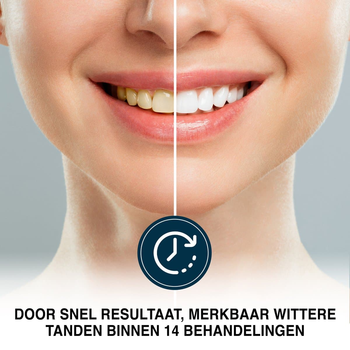 PurelyGoods Whitening Strips 14 Behandelingen thumbnail 4