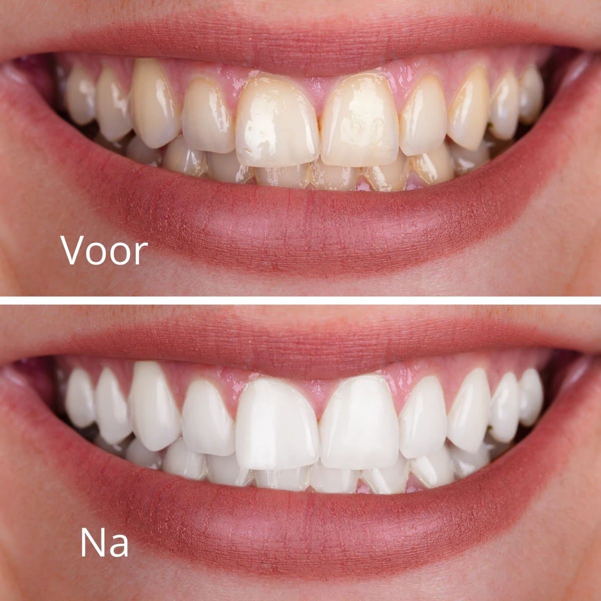 Smilekit V34 Colour Corrector Duopack thumbnail 7