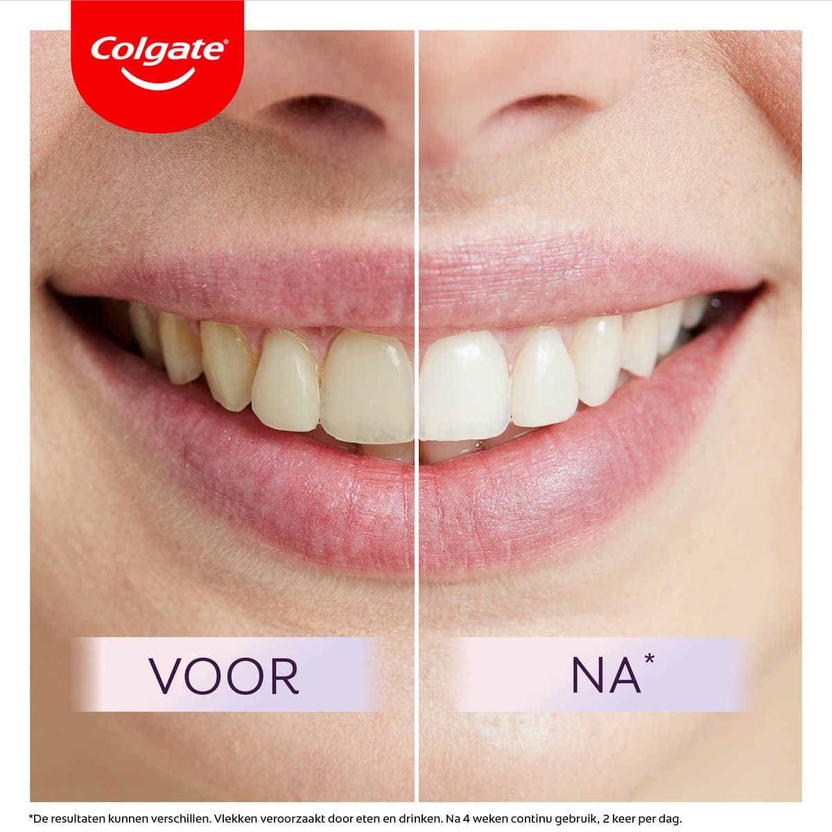 Colgate Max White Ultimate Radiance Whitening thumbnail 11