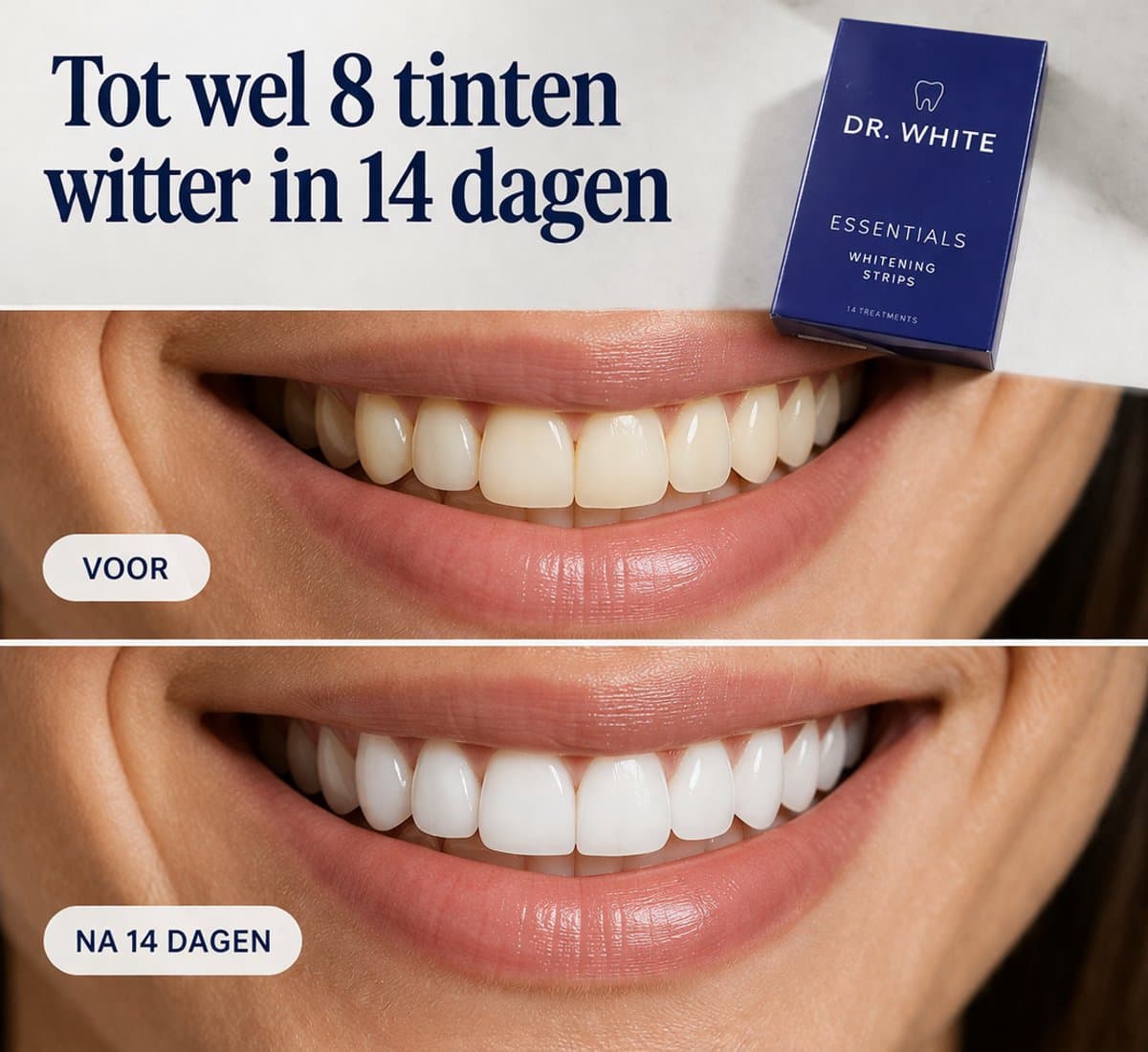 Whitening Strips thumbnail 5