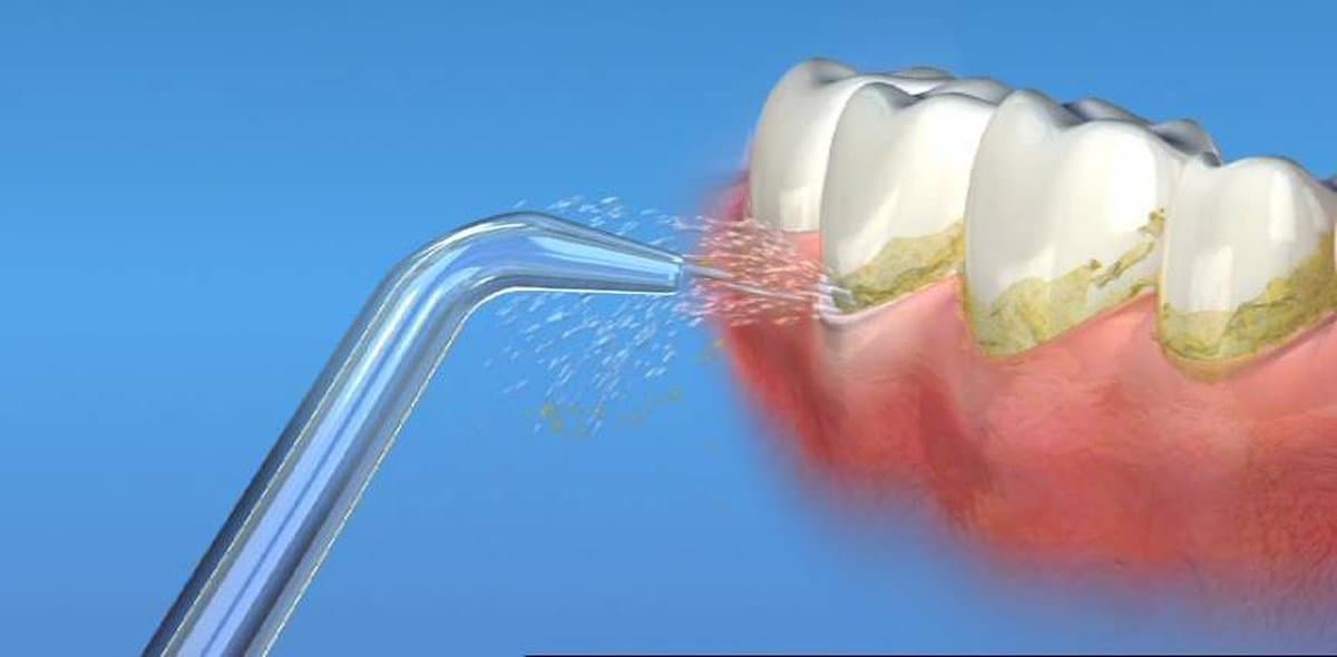 Waterpik JT-100 Jet Tips Opzetstukken (2 stuks) thumbnail 2