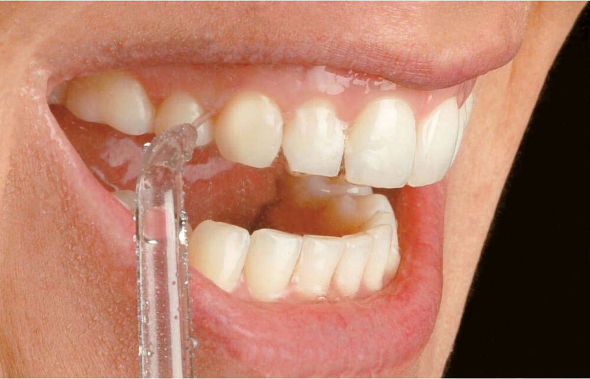 Waterpik JT-100 Jet Tips Opzetstukken (2 stuks) thumbnail 6