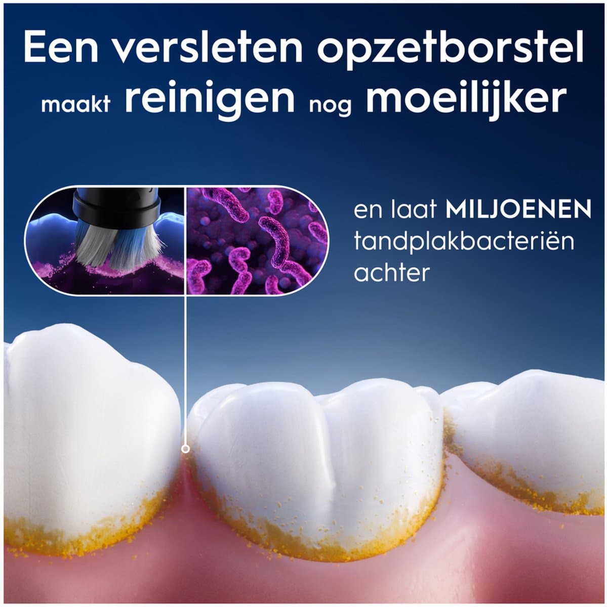 Oral-B iO Gentle Care opzetborstels thumbnail 10