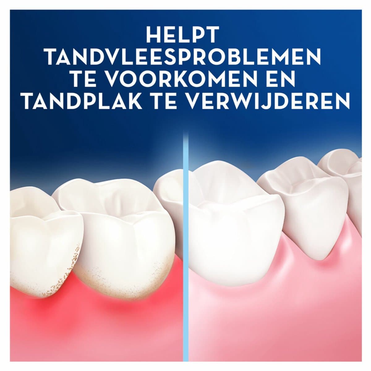 Oral-B Pro-Expert Flosdraad 2x50m thumbnail 4