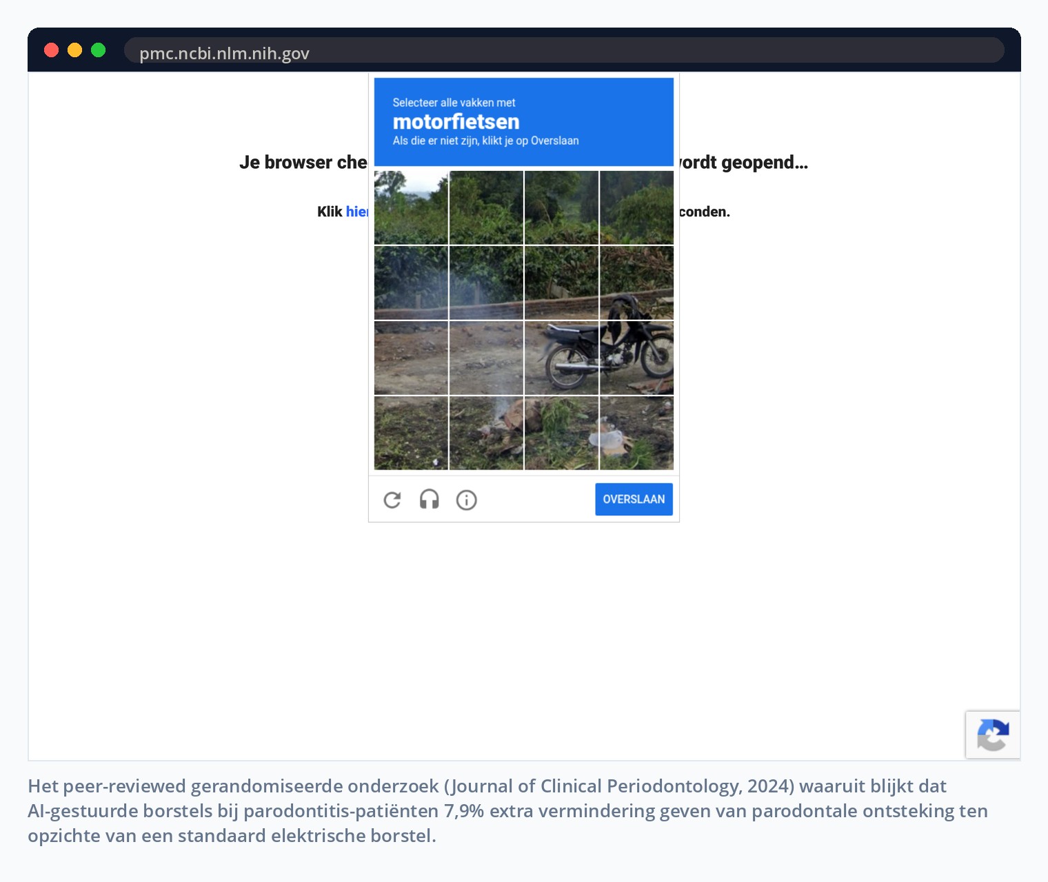 Het peer-reviewed gerandomiseerde onderzoek (Journal of Clinical Periodontology, 2024) waaruit blijkt dat AI-gestuurde borstels bij parodontitis-patiënten 7,9% extra vermindering geven van parodontale ontsteking ten opzichte van een standaard elektrische borstel.