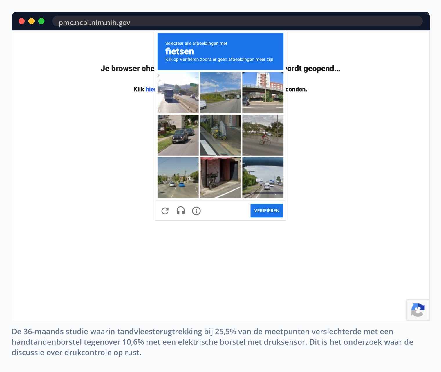 De 36-maands studie waarin tandvleesterugtrekking bij 25,5% van de meetpunten verslechterde met een handtandenborstel tegenover 10,6% met een elektrische borstel met druksensor. Dit is het onderzoek waar de discussie over drukcontrole op rust.