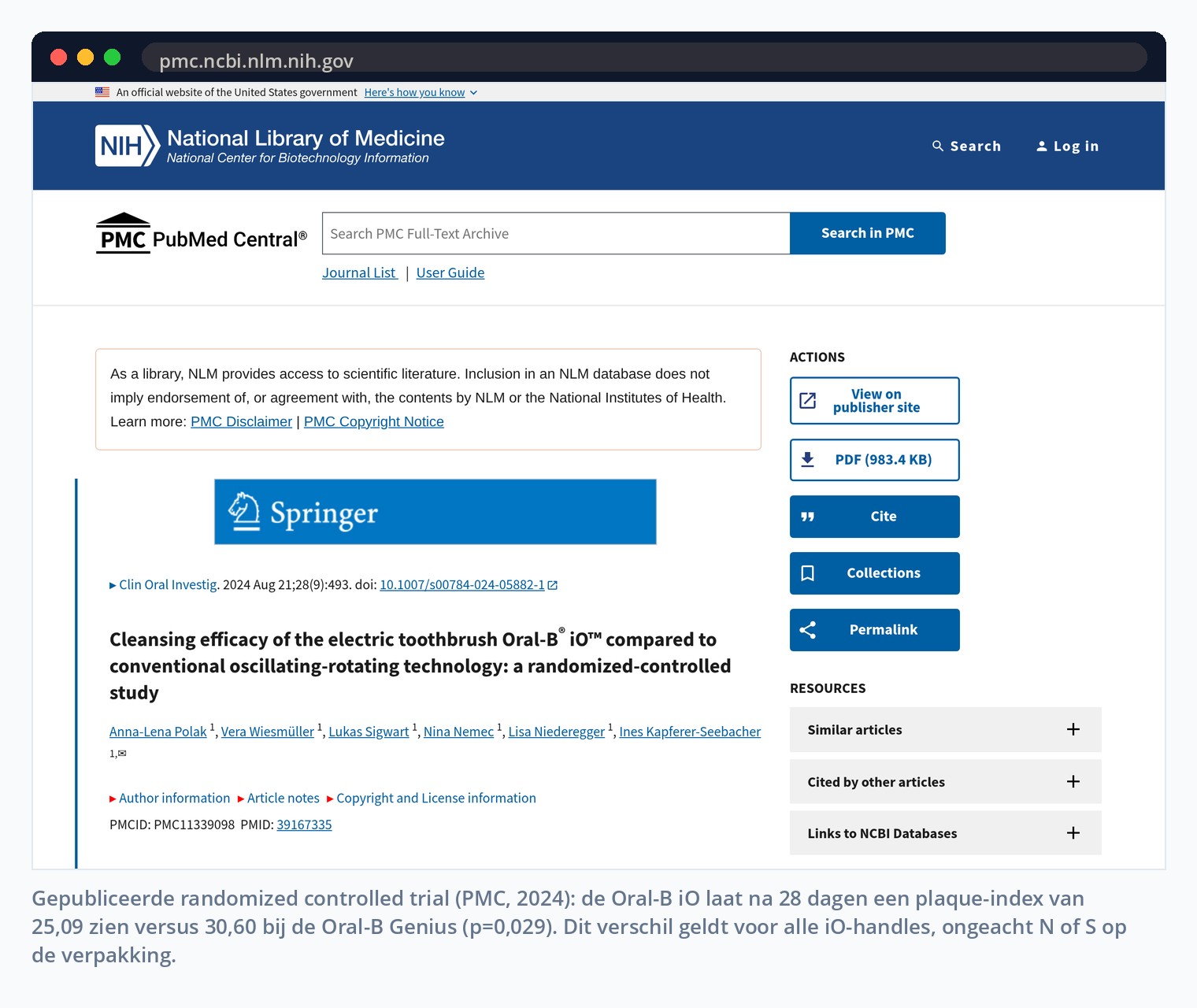 Gepubliceerde randomized controlled trial (PMC, 2024): de Oral-B iO laat na 28 dagen een plaque-index van 25,09 zien versus 30,60 bij de Oral-B Genius (p=0,029). Dit verschil geldt voor alle iO-handles, ongeacht N of S op de verpakking.