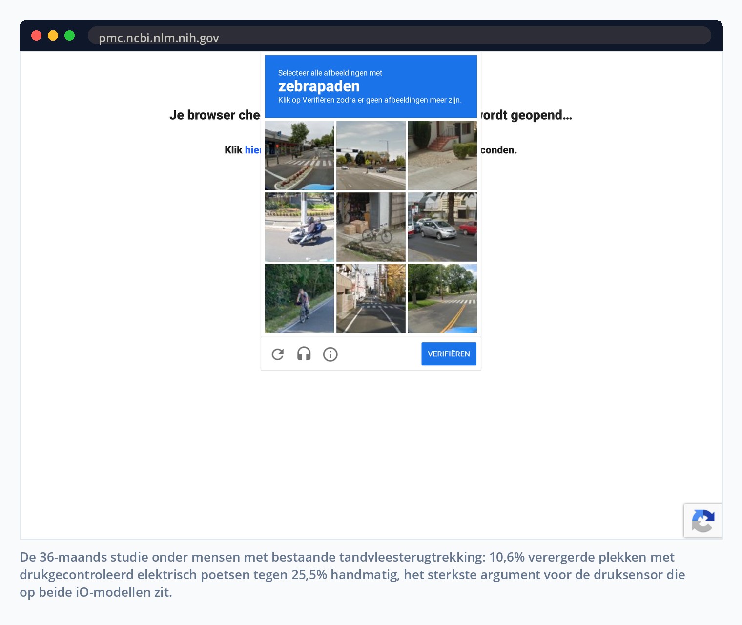 De 36-maands studie onder mensen met bestaande tandvleesterugtrekking: 10,6% verergerde plekken met drukgecontroleerd elektrisch poetsen tegen 25,5% handmatig, het sterkste argument voor de druksensor die op beide iO-modellen zit.