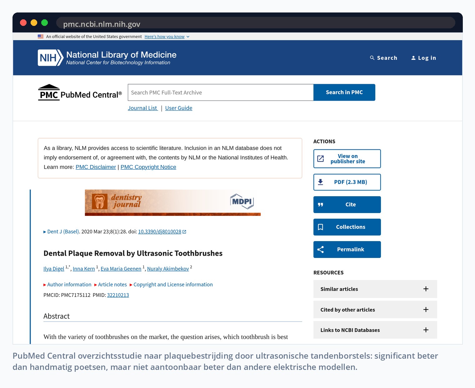 PubMed Central overzichtsstudie naar plaquebestrijding door ultrasonische tandenborstels: significant beter dan handmatig poetsen, maar niet aantoonbaar beter dan andere elektrische modellen.
